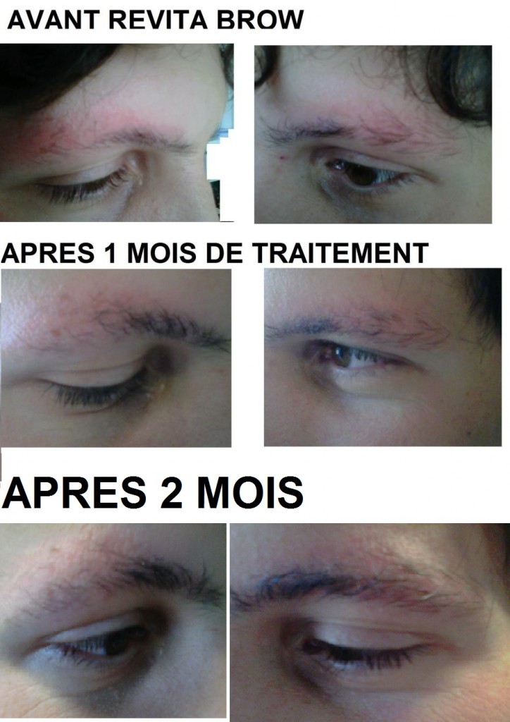 comment arreter de s arracher les sourcils