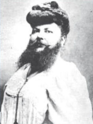 and now ladies and gentlemen,la femme à barbe,hirsutisme,jambes velues